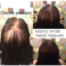 Cápsulas Crescimento Pantovin Para Cabelo E Unha  Antiqueda